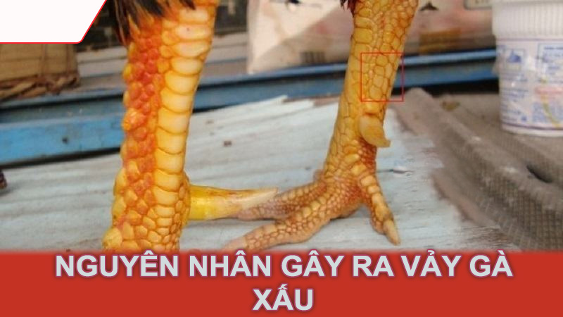 Nguyên nhân gây ra vảy gà xấu